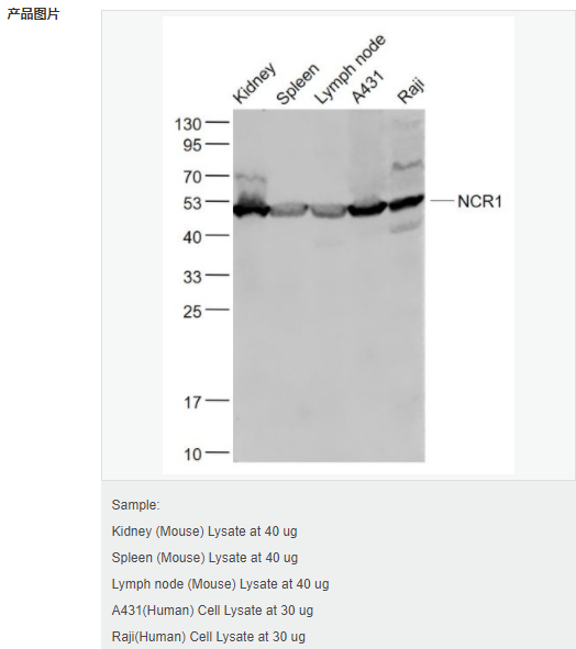 6066c4102321b.png image.png